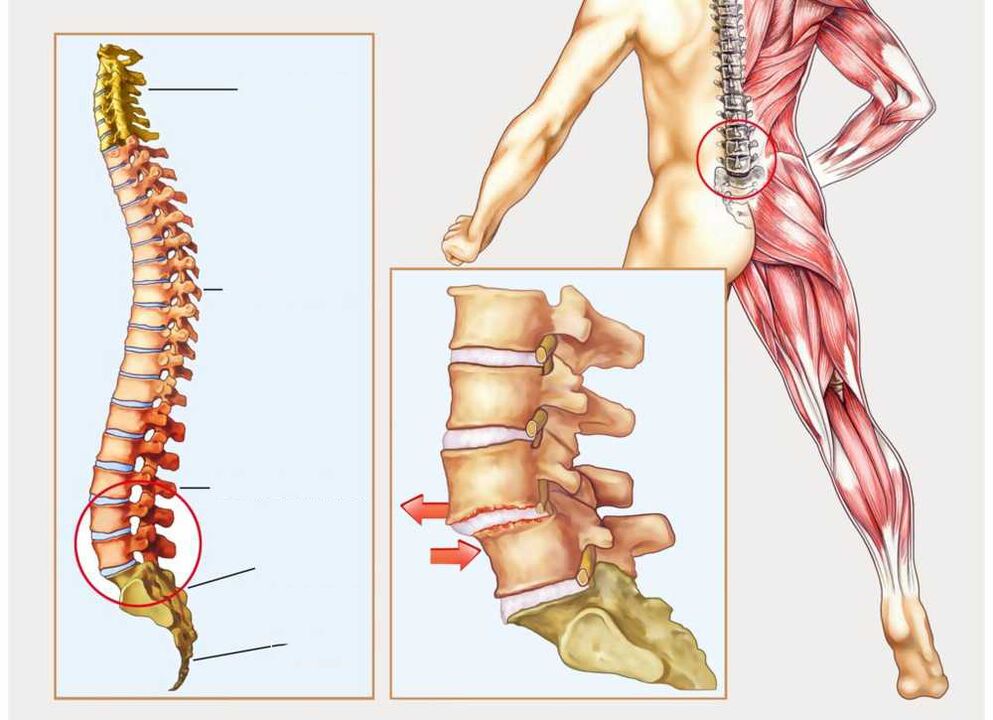 shpinë të shëndetshme dhe të sëmurë
