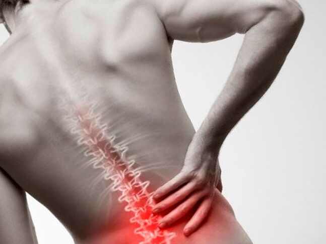 dhimbje në pjesën e poshtme të shpinës për shkak të osteokondrozës