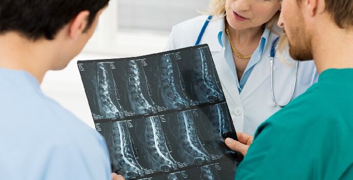 Rrezet X të shtyllës kurrizore si mënyrë për të diagnostikuar osteokondrozën