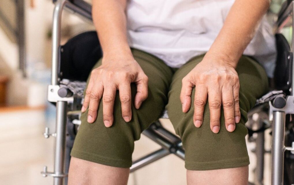Një pacient me artrozë të nyjeve të gjurit